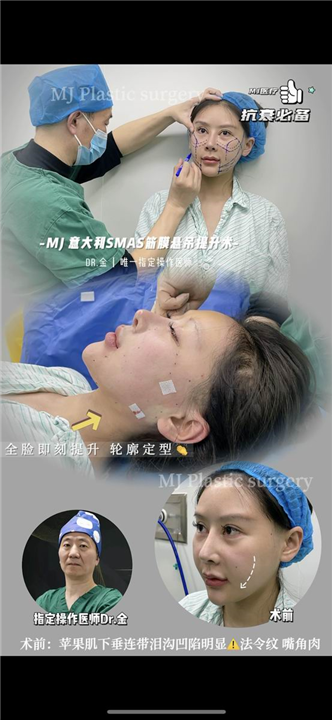 金晓东整形医生