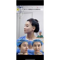 上海筋膜悬吊术