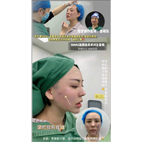 意大利筋膜悬吊术