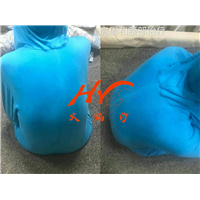 新疆沙疗养生 