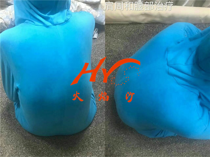 新疆沙疗养生 