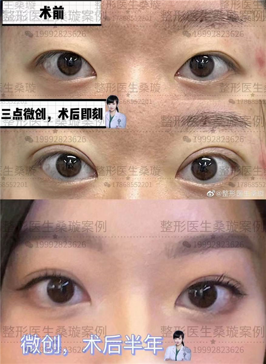 桑璇整形医生