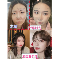 桑璇整形医生