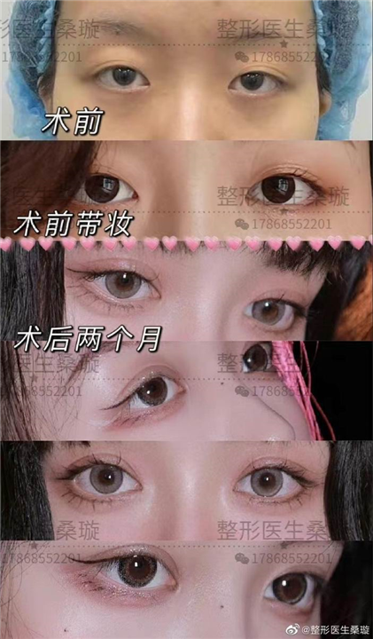 桑璇整形医生