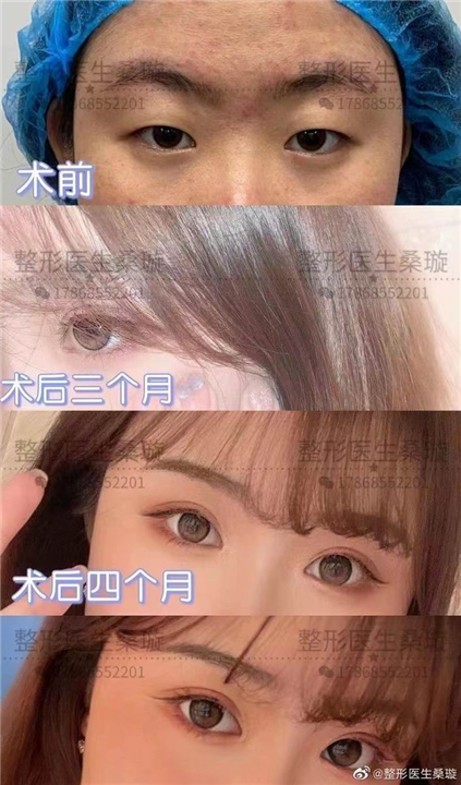 桑璇整形医生