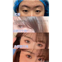 桑璇整形医生