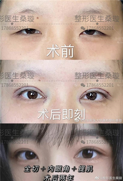 桑璇医生