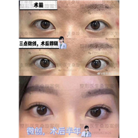 桑璇整形医生