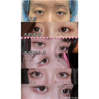 桑璇整形医生