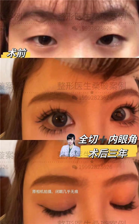 桑璇整形医生