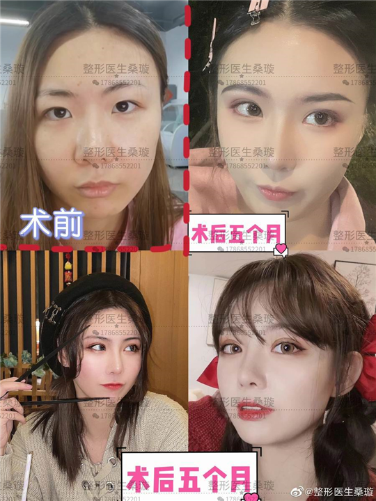 桑璇整形医生