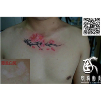 北京纹身* 昌平纹身