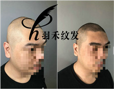 成都纹发