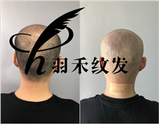 重庆纹发机构案例 