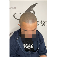 羽禾纹发案例2021