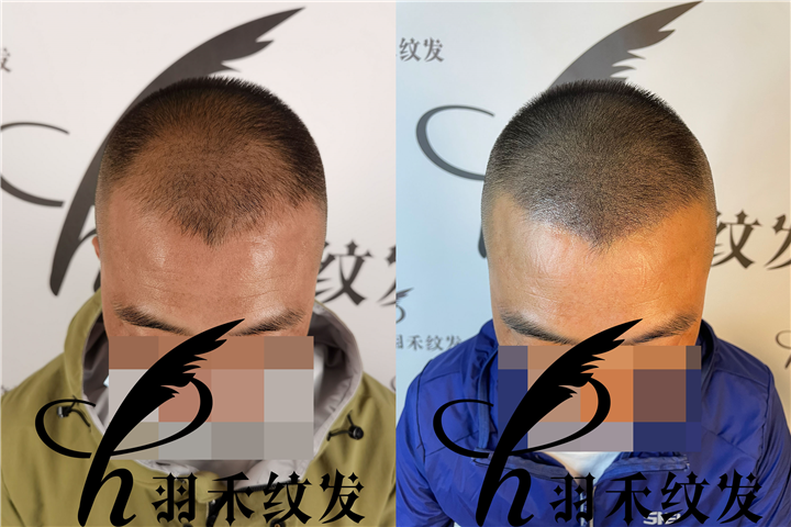 成都纹发哪家好