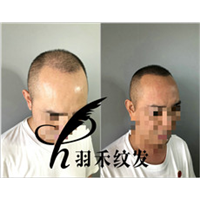 纹发案例、效果图