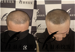 成都纹发、客户案例 