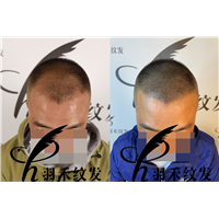 成都纹发哪家好