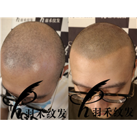 羽禾纹发前后