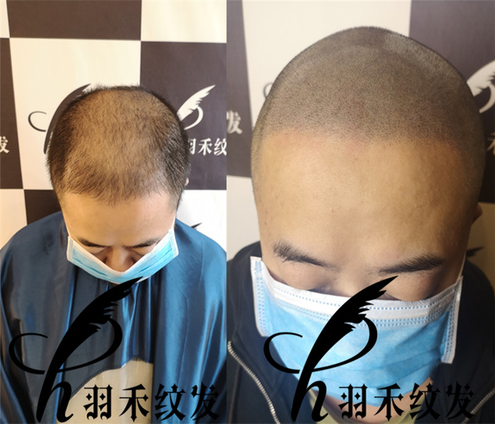 四川纹发、纹发 