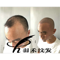 四川纹发案例效果图 