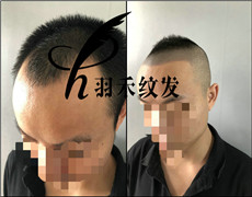 纹发效果图