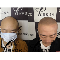 四川羽禾纹发机构案例