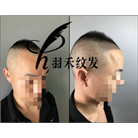 成都纹发案例
