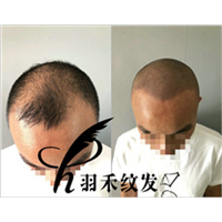 重庆纹发 