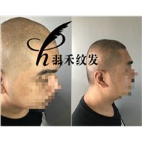 纹发机构