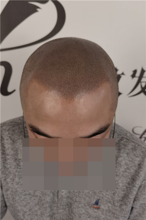 羽禾纹发前后2021