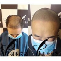 四川纹发、纹发 
