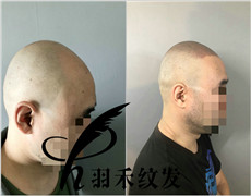 纹发案例