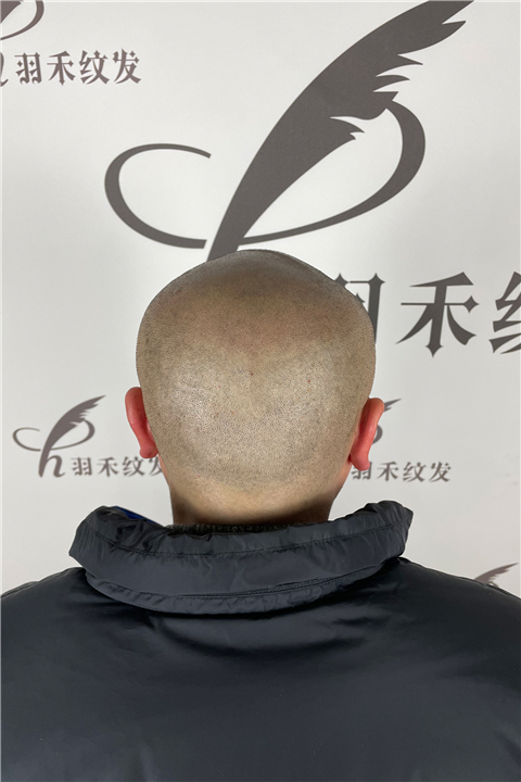 贵州纹发介绍