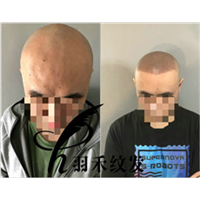 成都纹发
