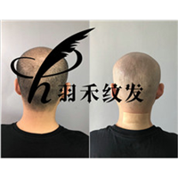 重庆纹发机构案例 