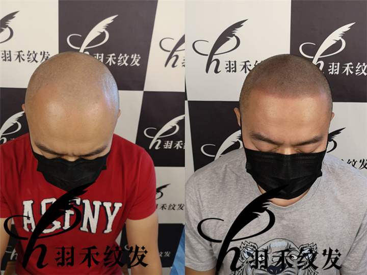 羽禾纹发前，纹发后 
