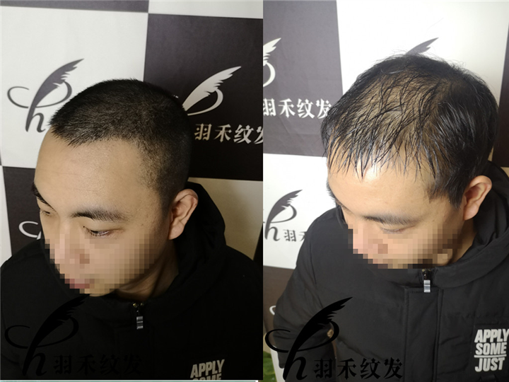 短发效果对比1 