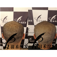 羽禾纹发前后案例