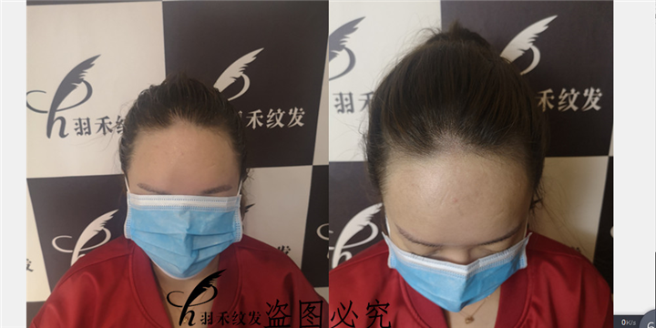 四川纹发对比照 