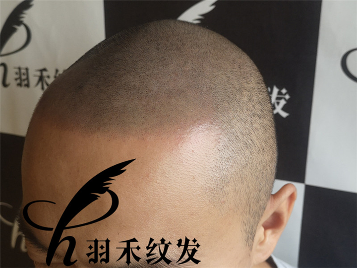 羽禾纹发机构客户案例