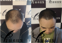 四川纹发，客户案例 