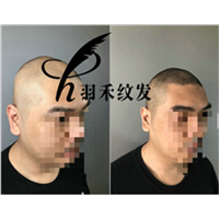 成都纹发