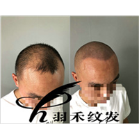 成都纹发效果图 