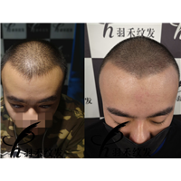 羽禾纹发机构案例