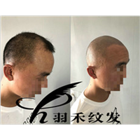 四川纹发前、纹发后 