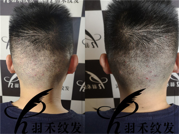 重庆纹发机构 