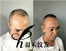 纹发案例、效果图