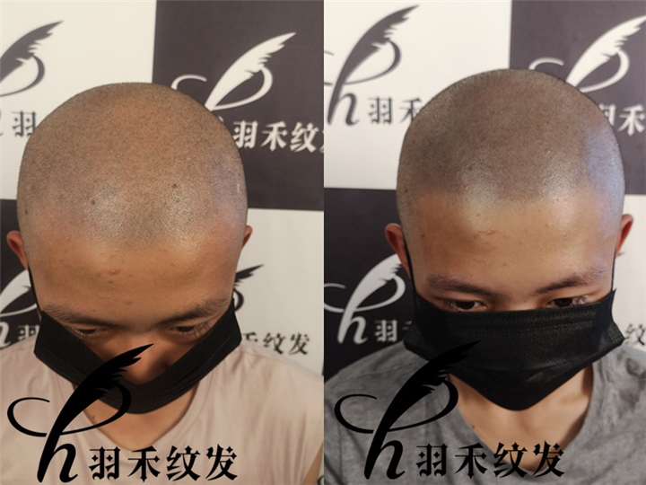 羽禾纹发机构案例